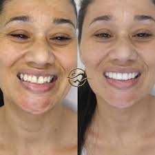 Sorrisos e Sonrisitas. (@sorrisosesonrisitas) · Instagram 照片和视频