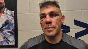 Matt Floyd GRUESOME INJURIES following James DeGale loss, #Boxing #BKFC