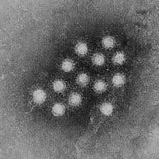 For clarity, the disease will be termed hepatitis a while the viral cause will be termed hav. Hepatitis A And Hepatitis B History Of Vaccines