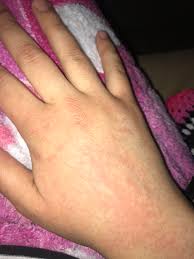 Then my finger just feel rough and dry, i continued work wearing new gloves. Anyone Hand Gets Like This After Ducking It In The Sanitizer Starbucks