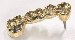 Where to sell dental gold. Questions To Consider About Your Dental Gold Chicago Gold Gallery