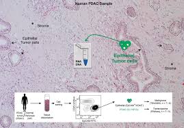 On day three of pdac, the inn team took to the floor once again to cover the convention, with highlights including visits from. Hi Stem Researchers Discover New Pancreatic Cancer Subtypes With Different Aggressiveness Publication In Cancer Discovery