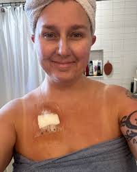 In December 2024, I began experiencing bouts of constipation and diarrhea.  I brushed it off, thinking it might be IBS or pre-menopause. Occasionally I  noticed a little blood, but with four kids