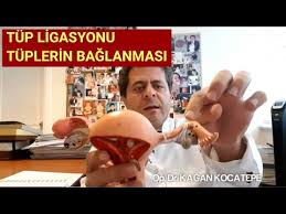 Tuplerini Baglatan Kadin Bir Daha Hamile Kalabilir Mi Youtube