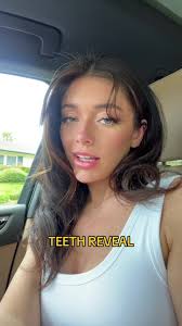 Tabitha Teeth Reveal