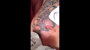 The area around your tattoo may be painful, swollen, red, and hot. This Gnarly Tattoo Infection Is Like An Alien In This Guys Body Youtube