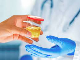 In fact, when using drug testing cups from 12 panel now, the process of administering the test and evaluating results should only take ten minutes or so. 10 Panel Drug Test Screened Substances Detection Times And More