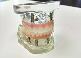 Maybe you would like to learn more about one of these? Fixed Dentures Hybrids Pro Dental Dallas Texas