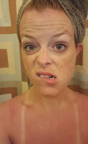 Family business experience with sunscreen and sunburn