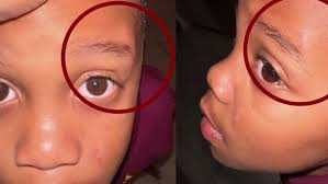 Special needs child suffers cuts, bruises after he says teacher punched him  in face for trying to perfect his homework