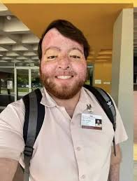 First day of med school after burning 71% of my body 3 years ago: 28  surgeries and more to come 20 days in a coma 2 months in ICU 7 months+ in