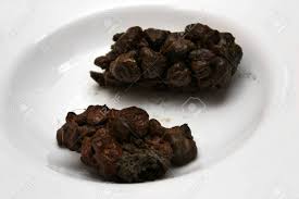 Image result for dark black stool human poop