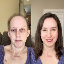 National Cancer Survivors Day