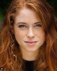 Why are bald heads common among Israelis?