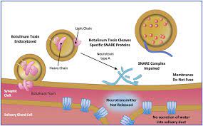 Clinical diagnosis and medical treatment. Mechanism Of Action Of Botulinum Toxin Type A Adapted From Arnon Ss Download Scientific Diagram