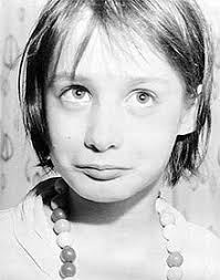 Your child needs a chickenpox vaccine because chickenpox can actually be a serious disease. Genie Feral Child Wikipedia
