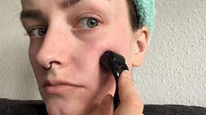Ich habe ein herz für familienunternehmen und menschen, die aus ihrer leidenschaft einen beruf machen. Microneedling Ich Habe Einen Dermaroller Zu Hause Getestet Stern De