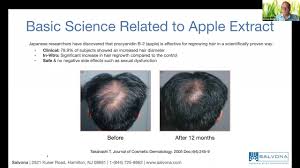 A laboratory study br j dermatol. Salsphere Natural Hair Growth Promoter Procyanidin B2 Apple Extract Raw Material To Be Added To Haircare Products