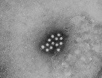Aug 28, 2020 · hepatitis a treatment usually focuses on keeping comfortable and controlling signs and symptoms. Hepatitis A Wikipedia
