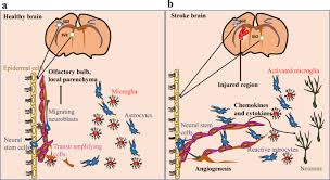The unied picture of cva and. Neurogenesis After Stroke A Therapeutic Perspective Springerlink
