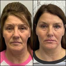 Stacey Koch, APRN (@stacey_koch.aprn) · Instagram photos and videos