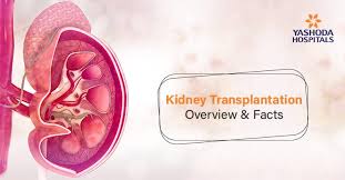 Kidney Transplant Types Procedure Risks Complications