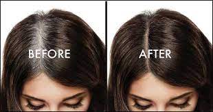 Eyebrows normally are of the same color, just like hairs. Why Hair Get White Get Rid Of White Hair Top To Find