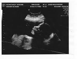 Semana 26 De Embarazo El Bebe Aprende A Coordinar Sus Movimientos