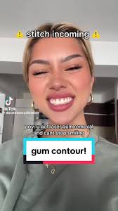Contouring Gums