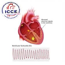 Check spelling or type a new query. Ø§ÙÙØ±ÙØ² Ø§ÙÙØªÙØ§ÙÙ ÙØ£ÙØ±Ø§Ø¶ Ù ÙÙØ±Ø¨Ø§Ø¦ÙØ© Ø§ÙÙÙØ¨ Ø§Ø¶Ø·Ø±Ø§Ø¨Ø§Øª ÙØ¸Ù Ø¯ÙØ§Øª Ø§ÙÙÙØ¨ Ø§ÙØ¨Ø·ÙÙÙ Ventricular Tachycardia Ø£Ù Ø¹Ø¯Ù Ø§ÙØªØ¸Ø§Ù Ø¯ÙØ§Øª Ø§ÙÙÙØ¨ Ø§ÙØ¨Ø·ÙÙÙ Premature Ventricular Contraction Ø§ÙØªÙ ØªÙØ´Ø£ ÙÙ ÙØ§Ø­Ø¯Ø© ÙÙ Ø§ÙØ¨Ø·ÙÙÙÙ