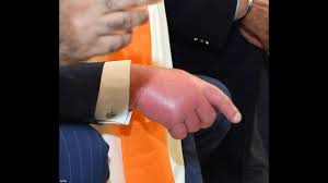 Britain's future king prince william is famously a leftie, and has been seen on a number of occasions signing guest books using his left hand. Prince Charles Suffers Puffy Feet And Hands After Nine Hour Long Haul Flight To India Youtube