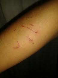 Resultado de imagen de rasguño