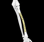 Surgical Technique