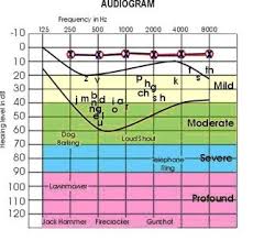 An Audiogram Is A Chart Created By The Audiologist To