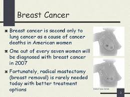 Often there is no external sign of breast cancer. Digital Mammography And Computeraided Diagnosis 1 Breast Cancer