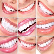 Field expertise to accommodate different dental needs. Las Vegas Cosmetic Dentist Absolute Dental