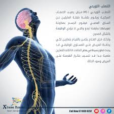 كيف يسبب مرض التصلب اللويحي تقلب المزاج ؟ بالإضافة إلى الشعور بالحزن والمشاعر العاطفية المختلفة بسبب العوامل الخارجية في البيئة من حولك، يمكن لمرض التصلب. Ø§Ù„ØªØµÙ„Ø¨ Ø§Ù„Ù„ÙˆÙŠØ­ÙŠ Ù‡Ùˆ Ù…Ø±Ø¶ Physiotherapist Wasfi M Alghool Facebook