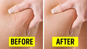 After you return to the start position repeat. 10 Exercises To Tone Your Thighs In 10 Minutes A Day Youtube