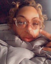 This was this morning. I'm still in the same spot 😂😂😩😩. #quarantined  #acidattacksurvivor #acidburnsurvior #burnsurvivor #scarredlittlebeauty  #imjustoutherebeatingtheoddsandish ##enddomesticviolence💜 #isurvivedit  #greeneyebandit #trayflowlocs ...