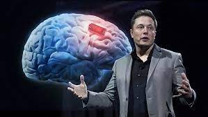 Tự chỉnh video, kể chuyện bằng... chip não Neuralink