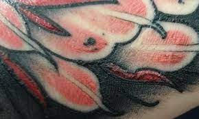 Is My Tattoo Infected Or Is This Nomral Raised Black Tattoos I Tattoo Prison Tattoos