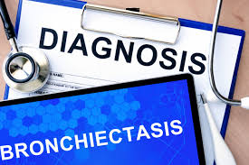 Copd diagnosis and treatment guideline. Bronchiectasis In Copd Diagnosis Treatment And Research Challenges