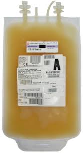 Image result for Platelet Transfusion