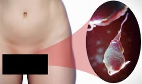 Image result for Trichomoniasis