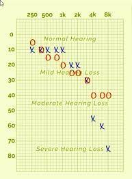How the free online hearing test works. How Accurate Are Online Hearing Test Question And Answer Hearing Aid Forum Active Hearing Loss Community