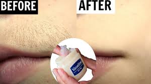 Remove Unwanted Hair Permanently| Vaseline Hair Removal | Hair Removal  Naturally At Home - Youtube