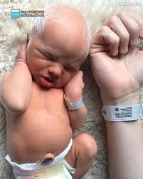 People called him “grandpa” when he was born, joking he looked old. But  just wait until you see him today