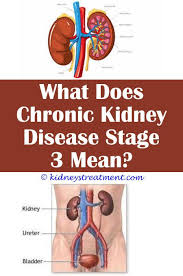 Pin On What Is Kidney Disease