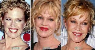 It certainly can be, when it's more natural (like in her before picture), but here it just . Melanie Griffith Obvious Plastic Surgery Herinterest Com
