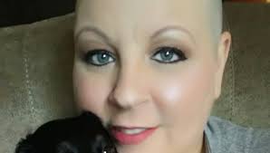 Stupid question time. I didn't know I was a carrier of a mutated gene until  after my child was diagnosed some years ago. As a carrier would or could we  have symptoms